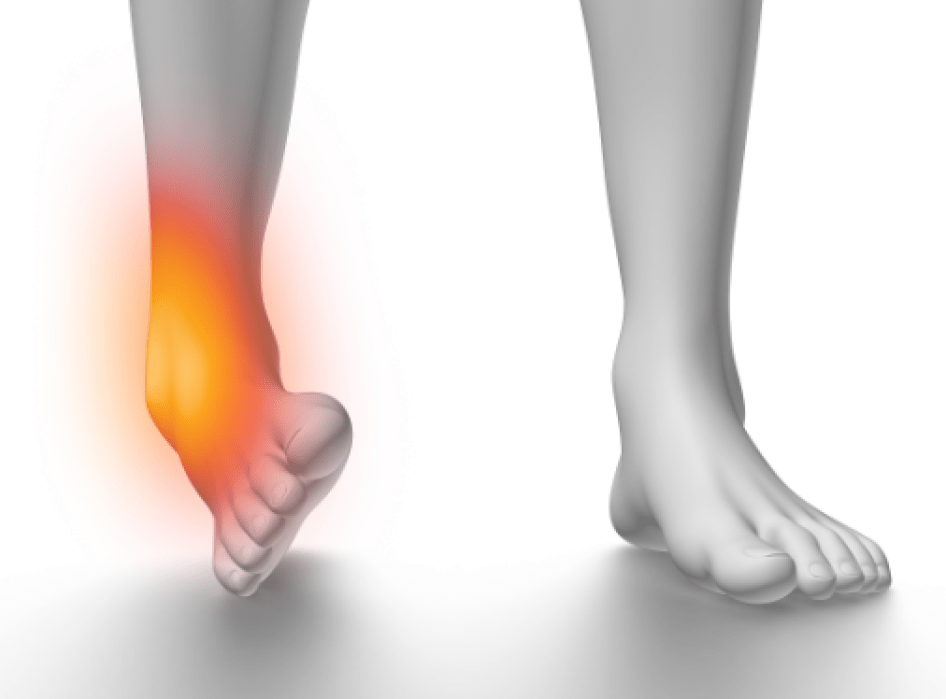 足首の捻挫はいつからマッサージを始められますか?